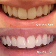 Load image into Gallery viewer, Snow Teeth Whitening™ At-Home System All-in-One Kit
