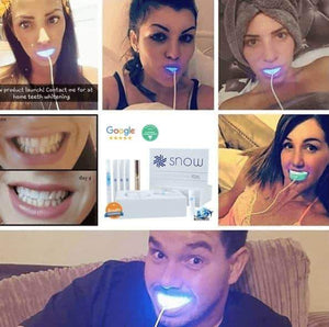 SNOW TEETH WHITENING™ – SYSTEM DO WYBIELANIA ZĘBÓW W DOMU [ZESTAW WSZYSTKO W JEDNYM]