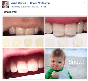 SNOW TEETH WHITENING™ SYSTÈME À DOMICILE [KIT TOUT-EN-UN]